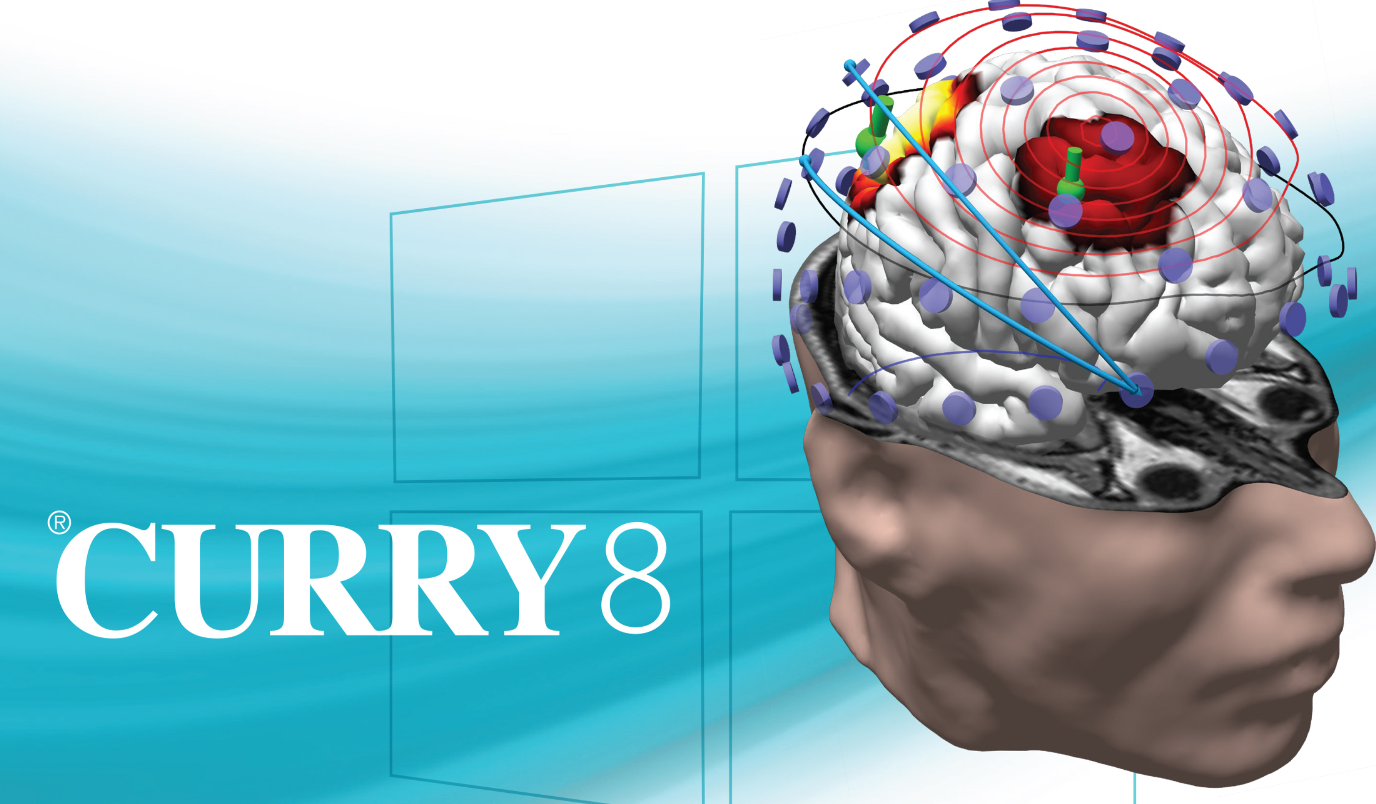 Electroencephalogram (EEG)